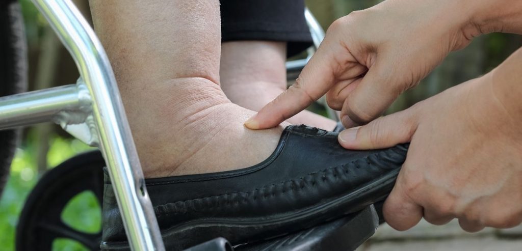 Top Diabetic Slippers For Swollen Feet
